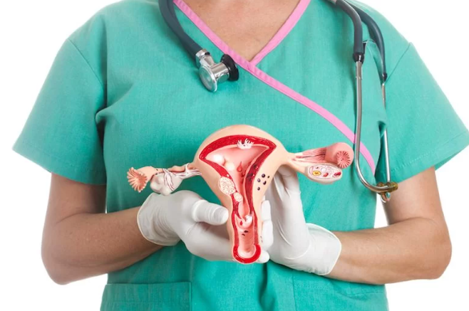 Salud ginecológica/ Fibromas uterinos, una preocupación constante para las mujeres