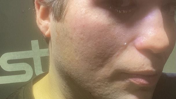 Chofer de Uber fue brutalmente agredido en Río Grande por pasajeros violentos Chofer de Uber fue brutalmente agredido en Río Grande por pasajeros violentos